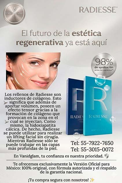 Radiesse plantilla