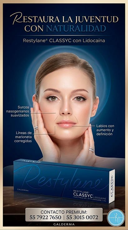 restylane classyc plantilla
