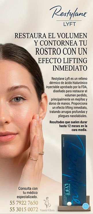 restylane lyft plantilla